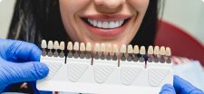 Porcelain veneers in Leigh